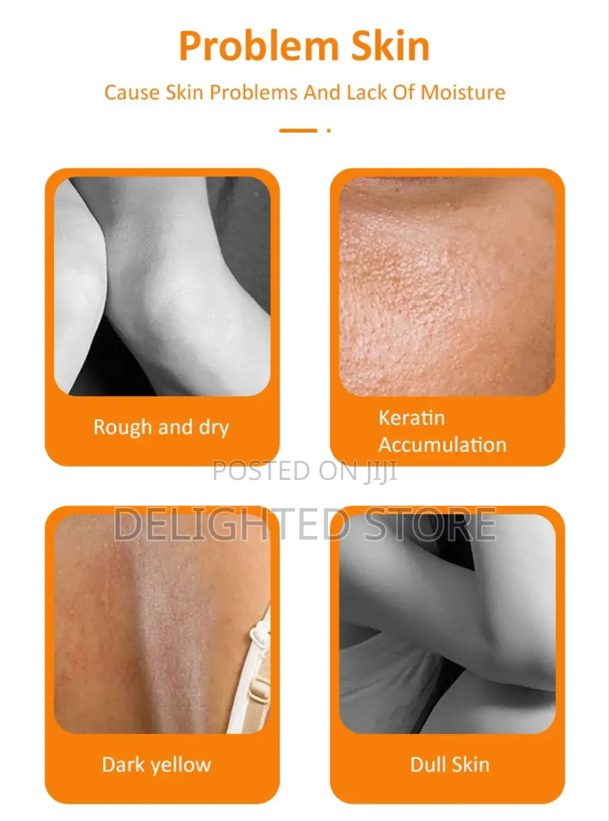 Mooyam Orange Peeling Lotion