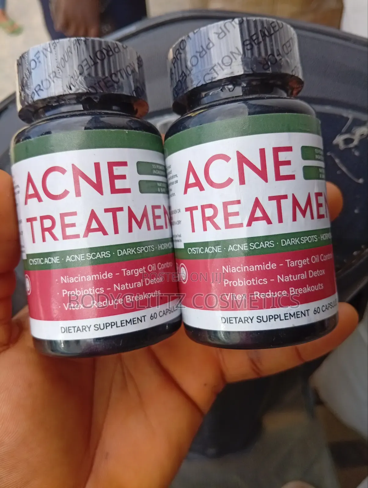 Acne Treatment Capsules