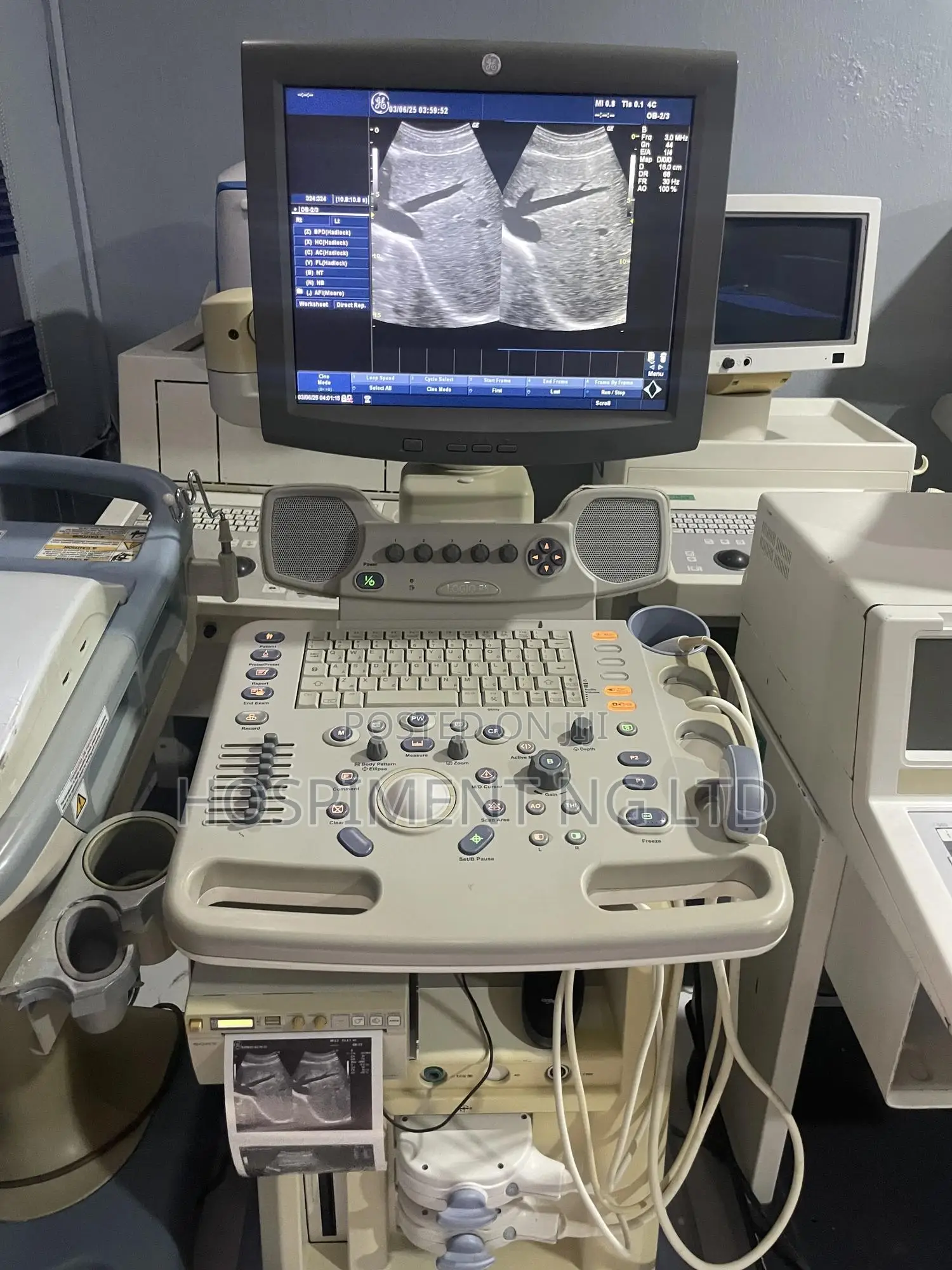 Ge Logic P5 Ultrasound Machine