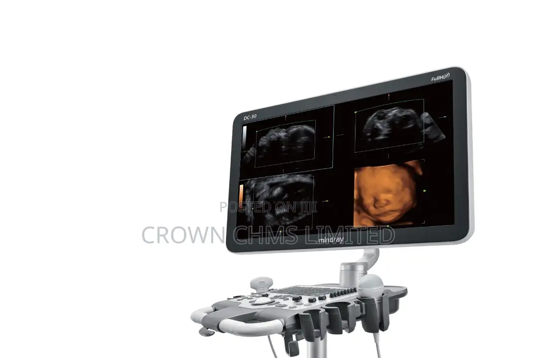 Mindray Dc-30 FHD – Clarity. Confidence. Convenience