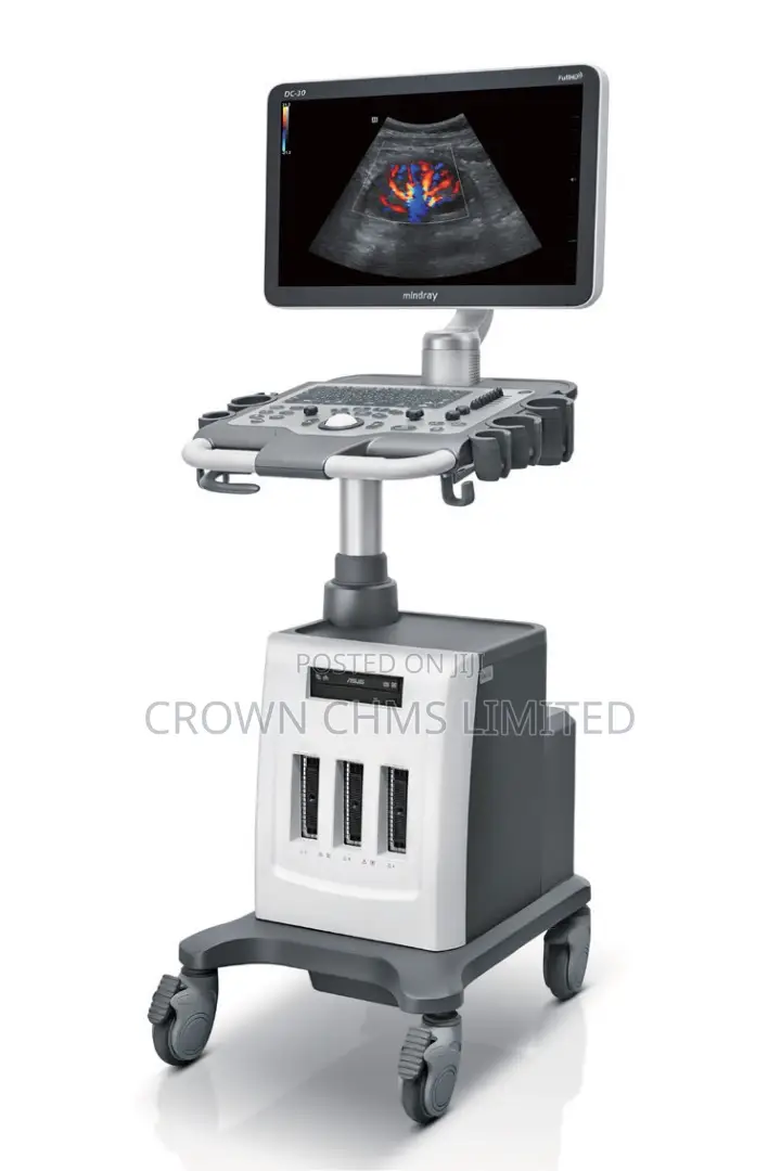 Mindray Dc-30 FHD – Clarity. Confidence. Convenience