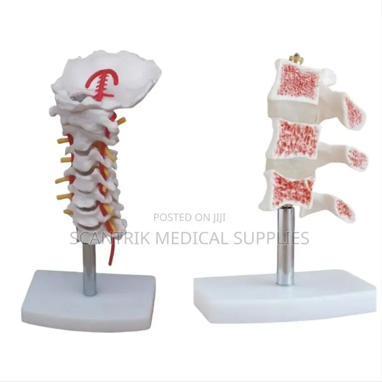 Cervical Spinal Column With Arteries