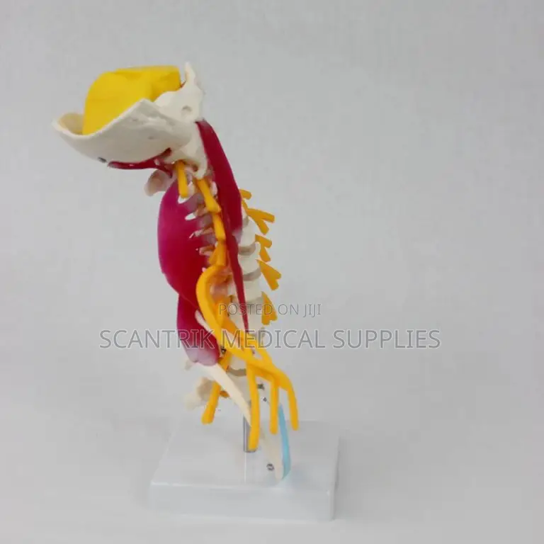 Cervical Vertebral Model With Vessels