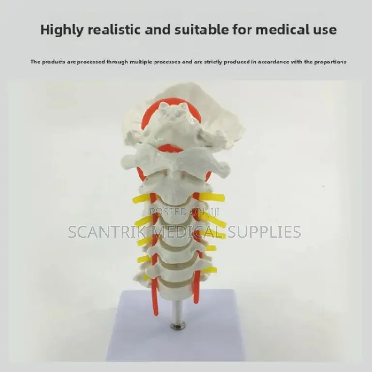 Upper Spinal Vertebrae and Arteries