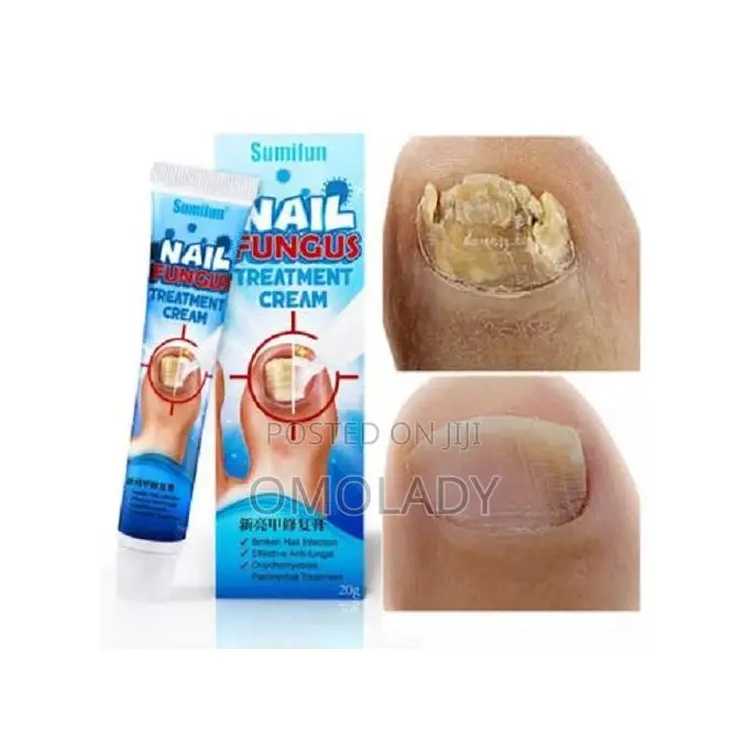 Sumifun Nail Fungus Treatment Liquid - 20ml