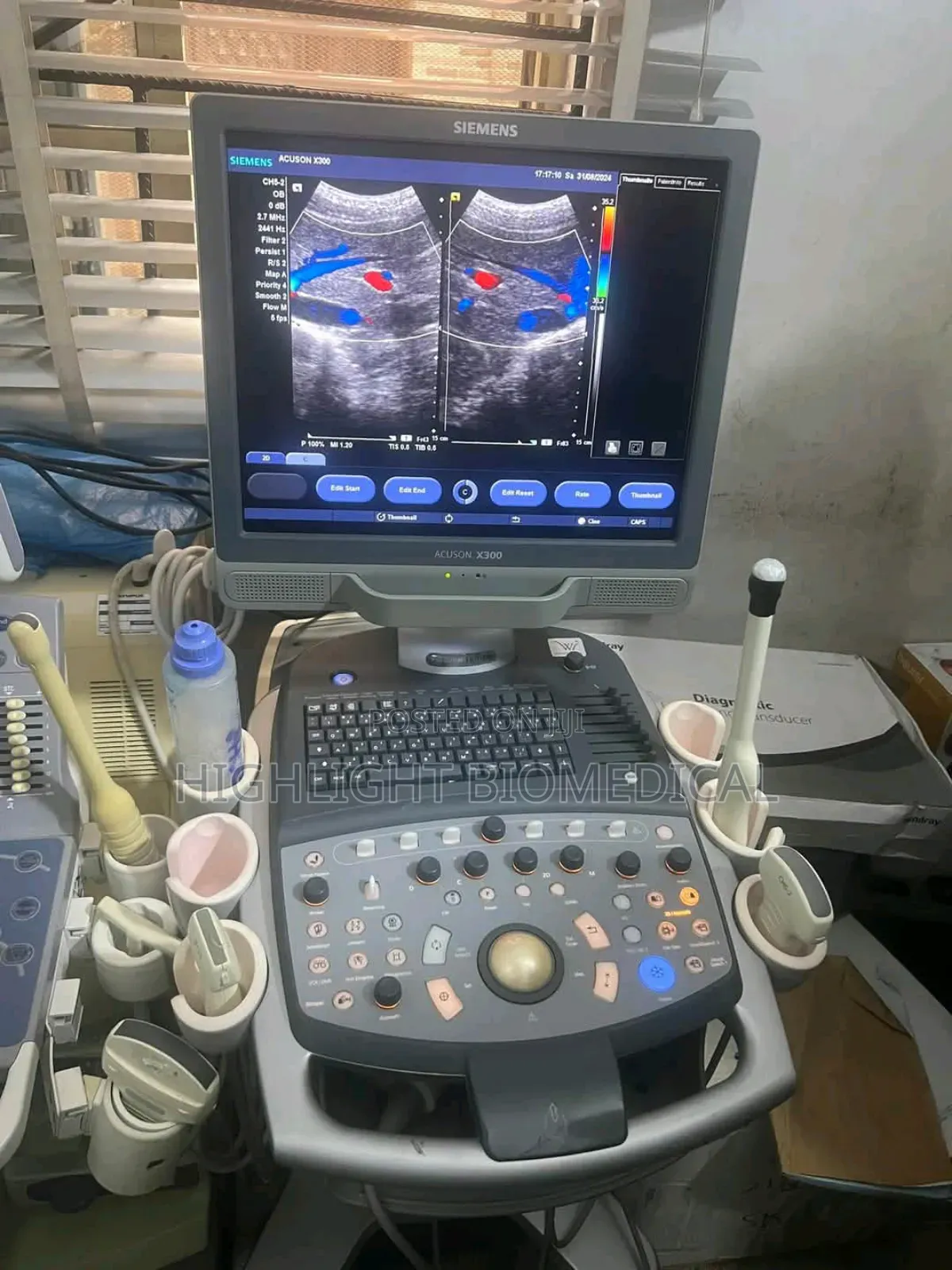 Siemens Acuson X300