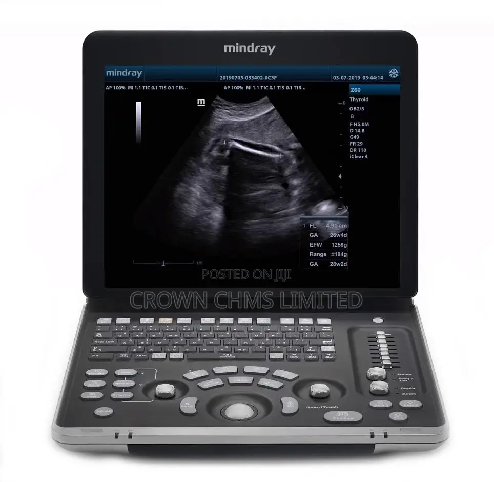 Mindray Z60mindray Z60 Ultrasound System