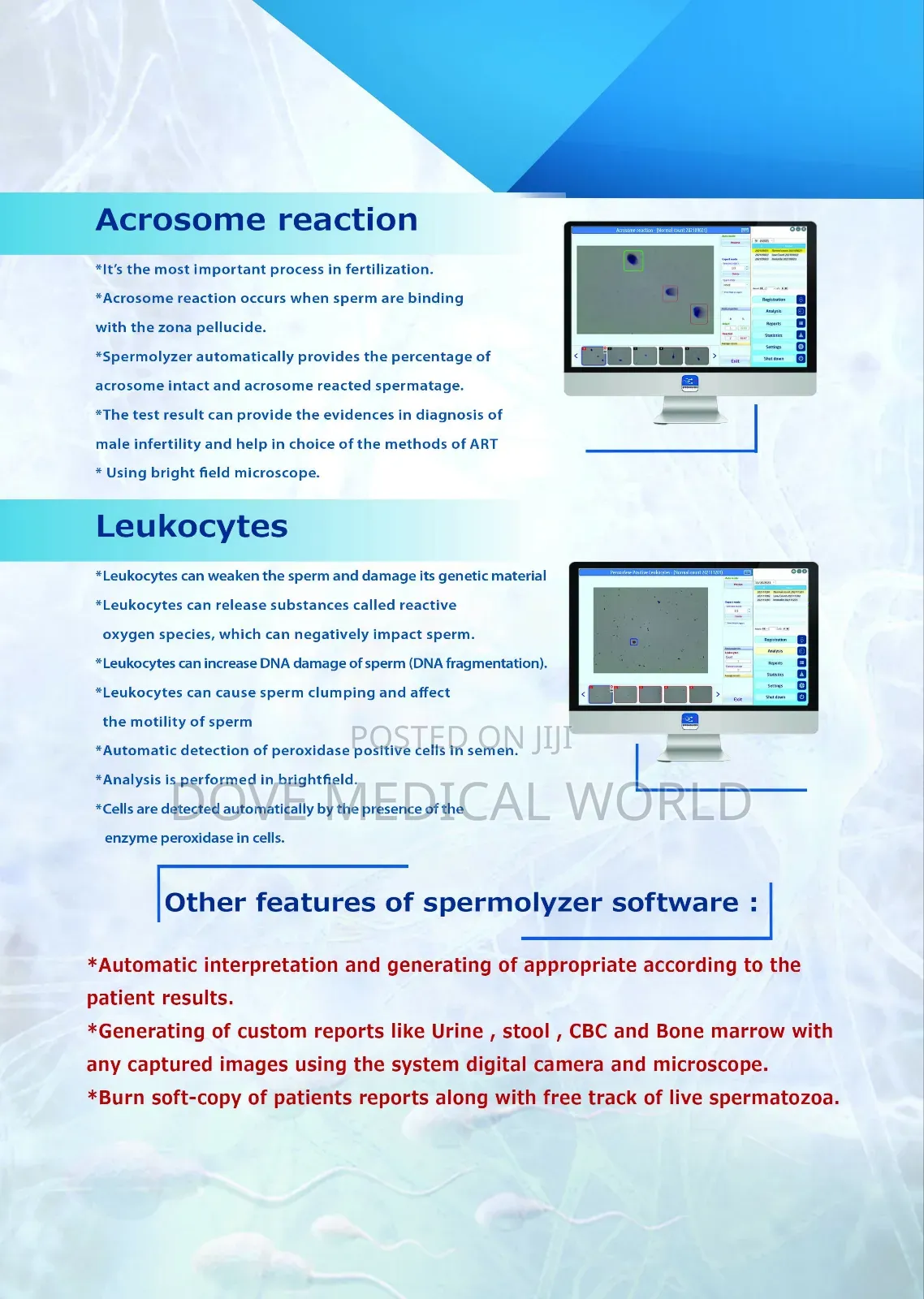 Sperm Analyzer
