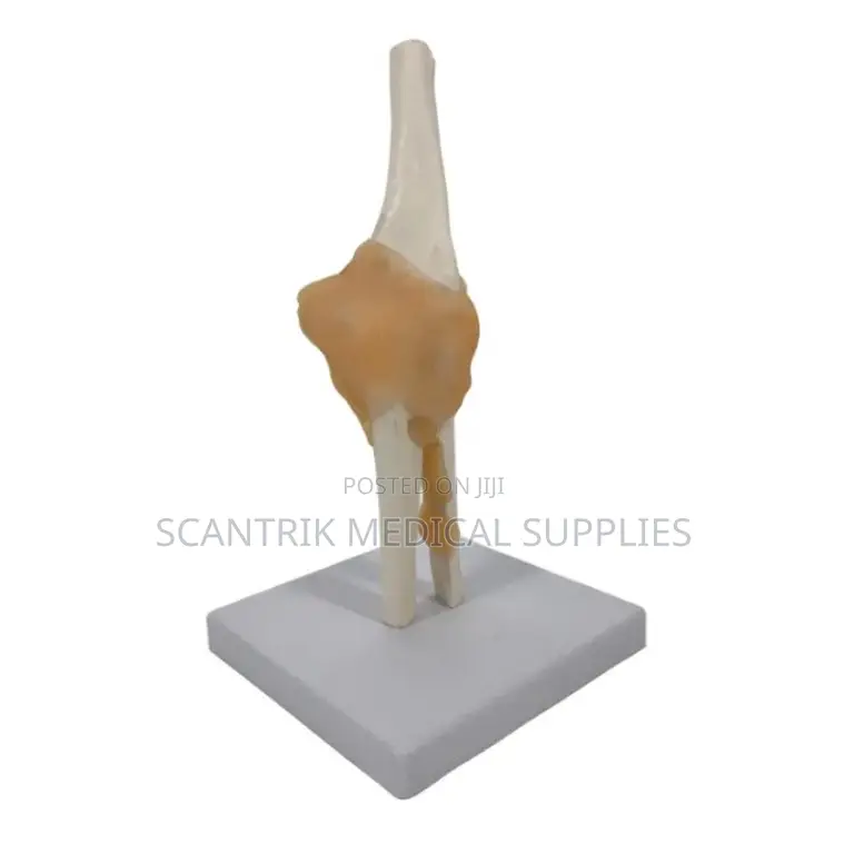 Elbow Joint With Ligament Model
