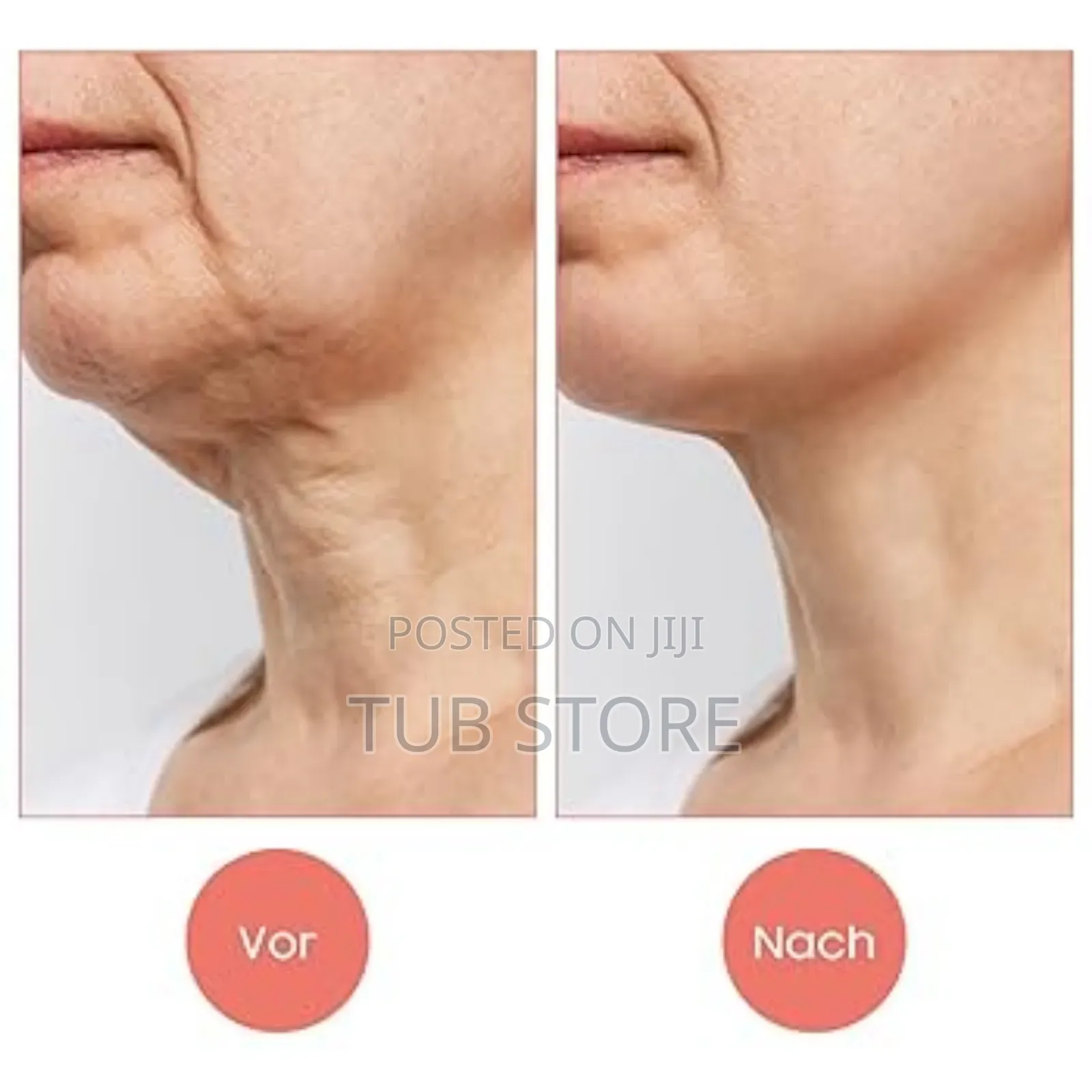 Intense Pulsed Light Wrinkles Reducing Instrument. Face Lifter Machine