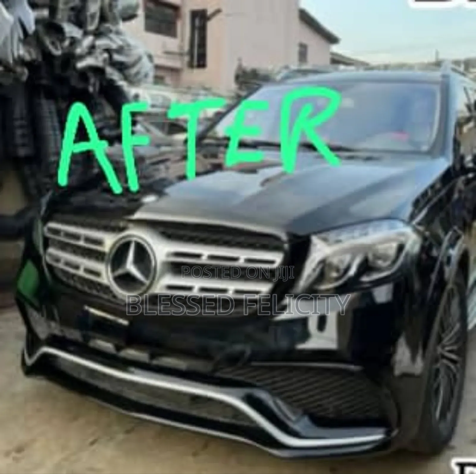 Complete Kit for Upgrading Mercedes Benz Gl to 2018 Gl