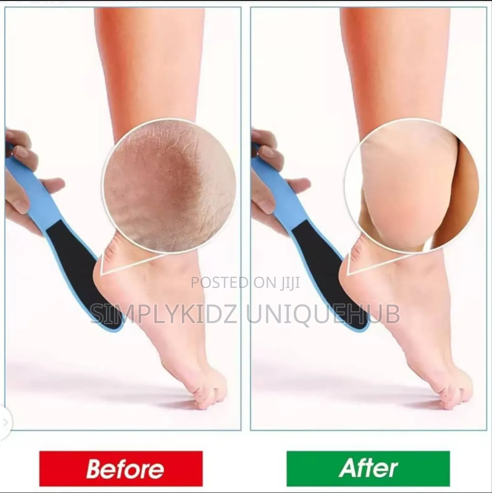 Pedicure Foot File