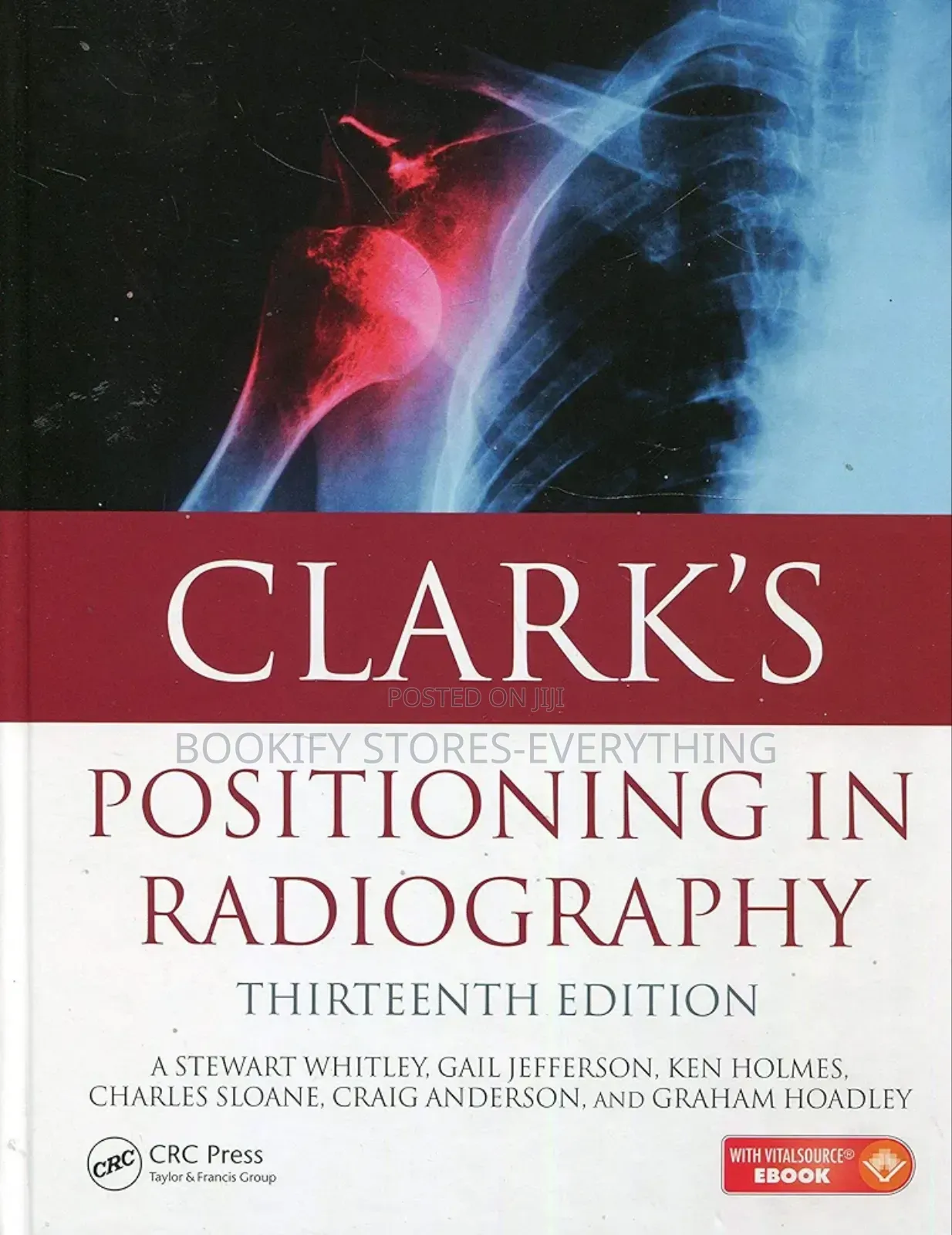 Clark's Positioning in Radiography
