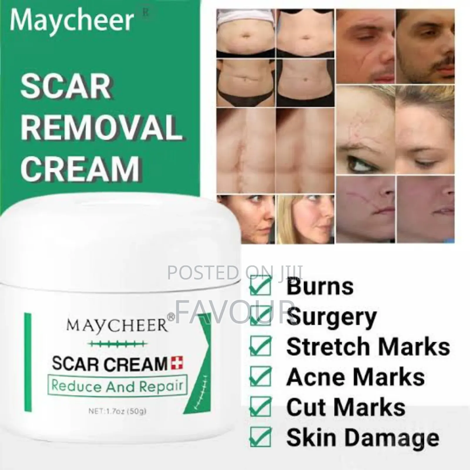 Super Effective Scar Removal Cream