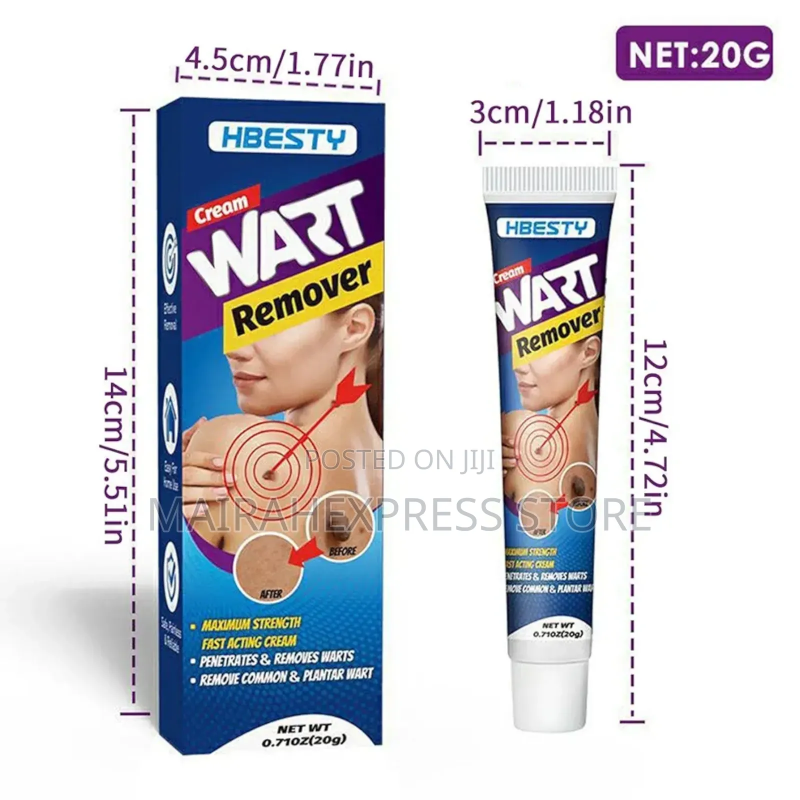 Hbesty Warts/Skin Tags Remover Cream (100% Surest Solution)