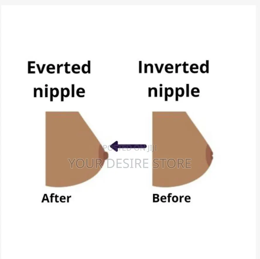 Lotan Nipple Corrector- For Flat Inverted Nipples; 2pcs