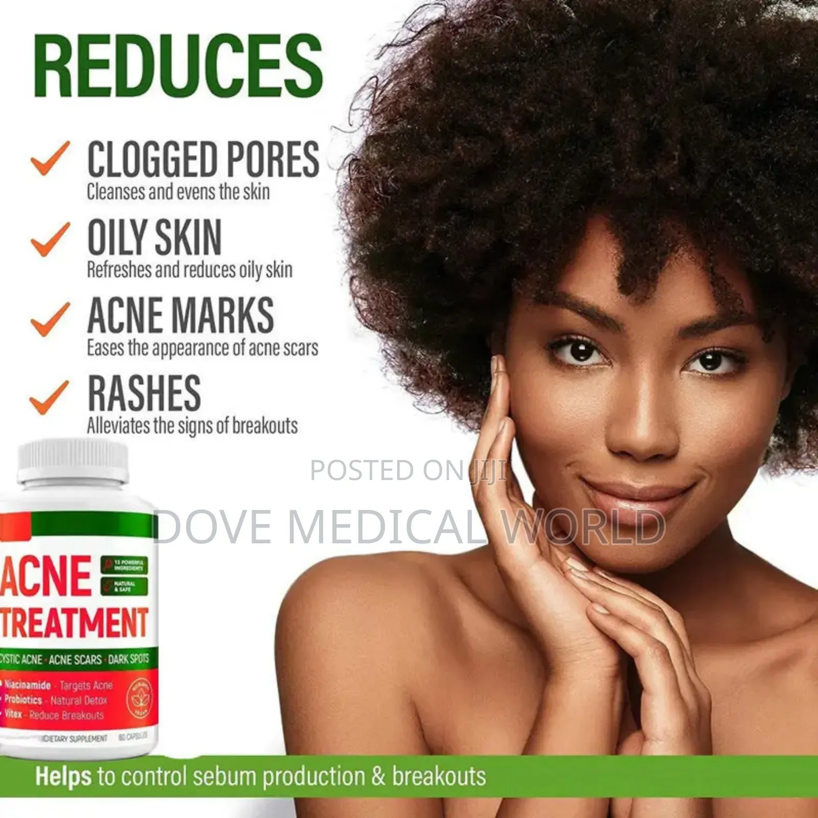 Acne Treatment Capsules