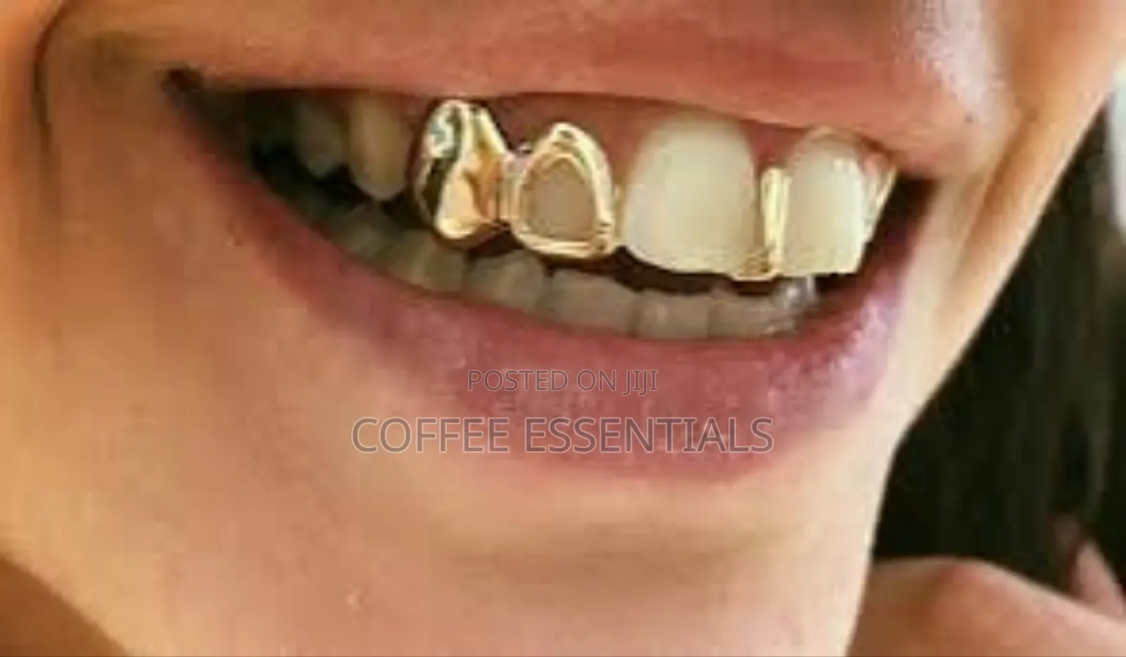 Hip-Hop Teeth Grills