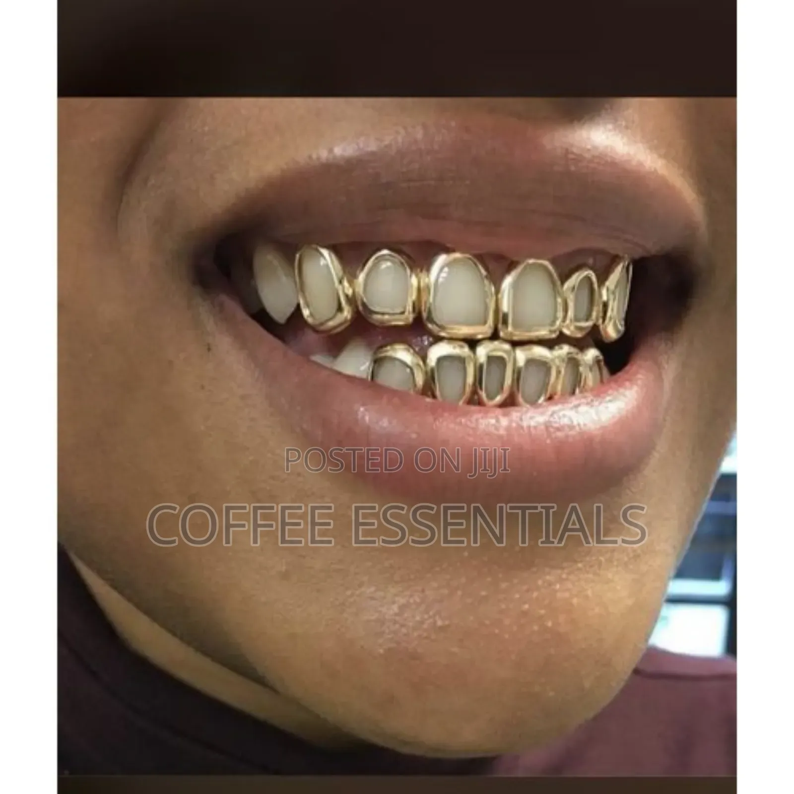 Hip-Hop Teeth Grills