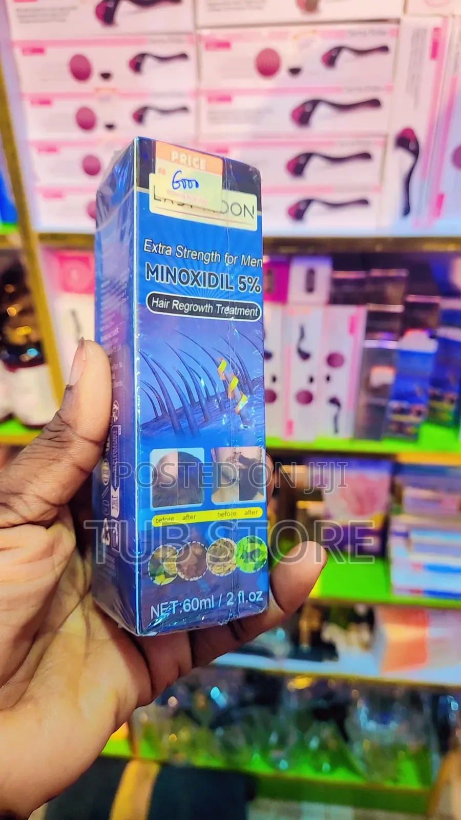 Minoxidil 5% Hair Regrowth Treatment