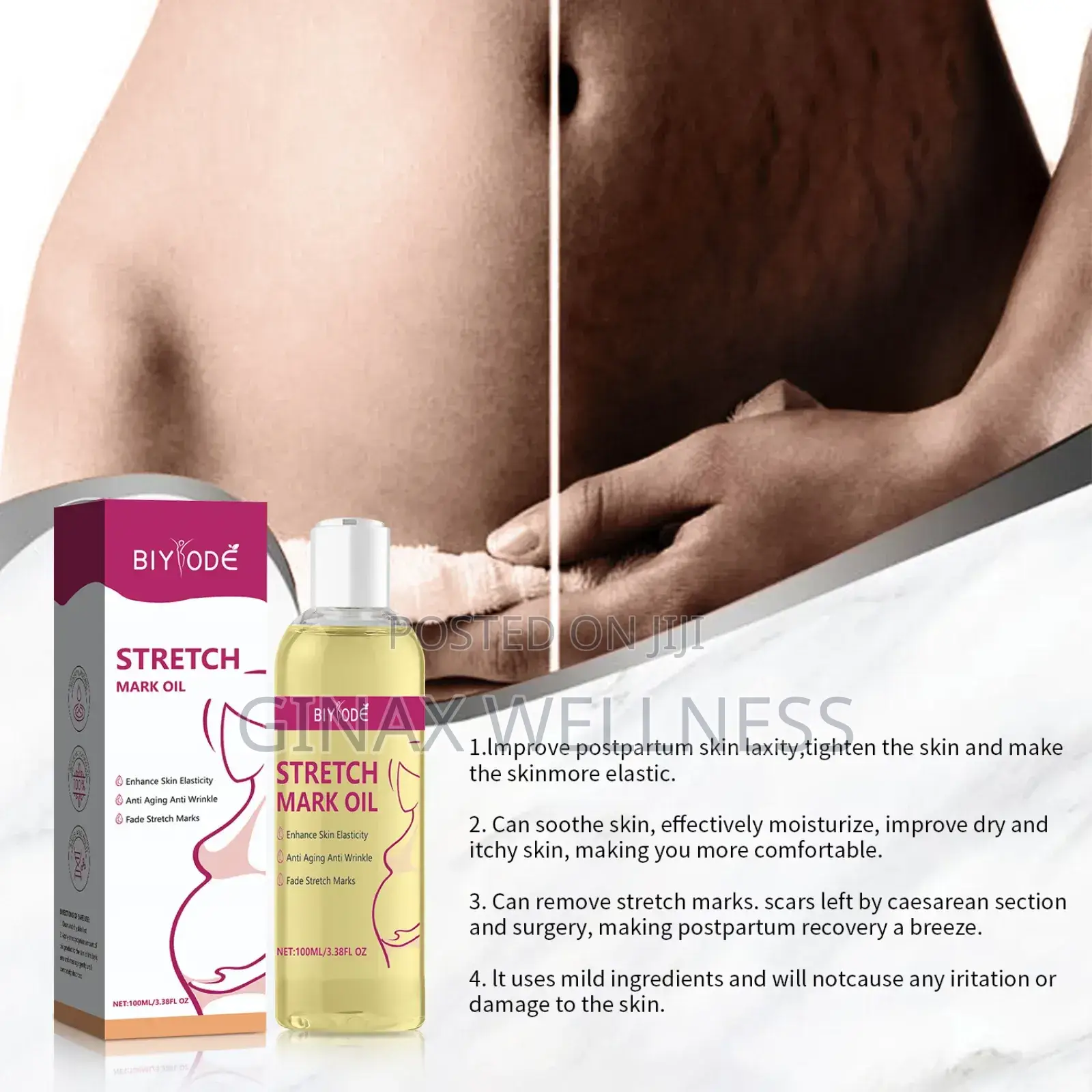 Biyode Stretch Mark Oil (100ml)