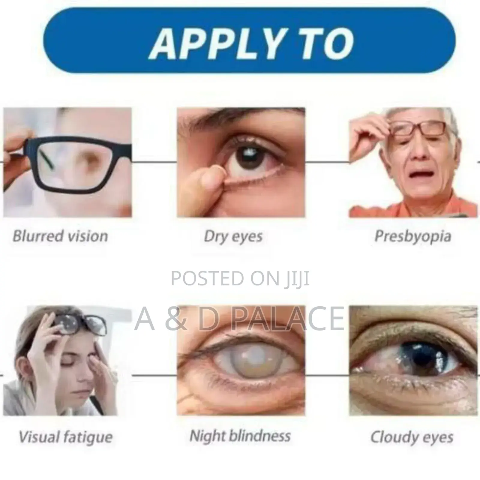 South Moon Cold Compress Gel for Dry Eyes Glaucoma Blurred Vision