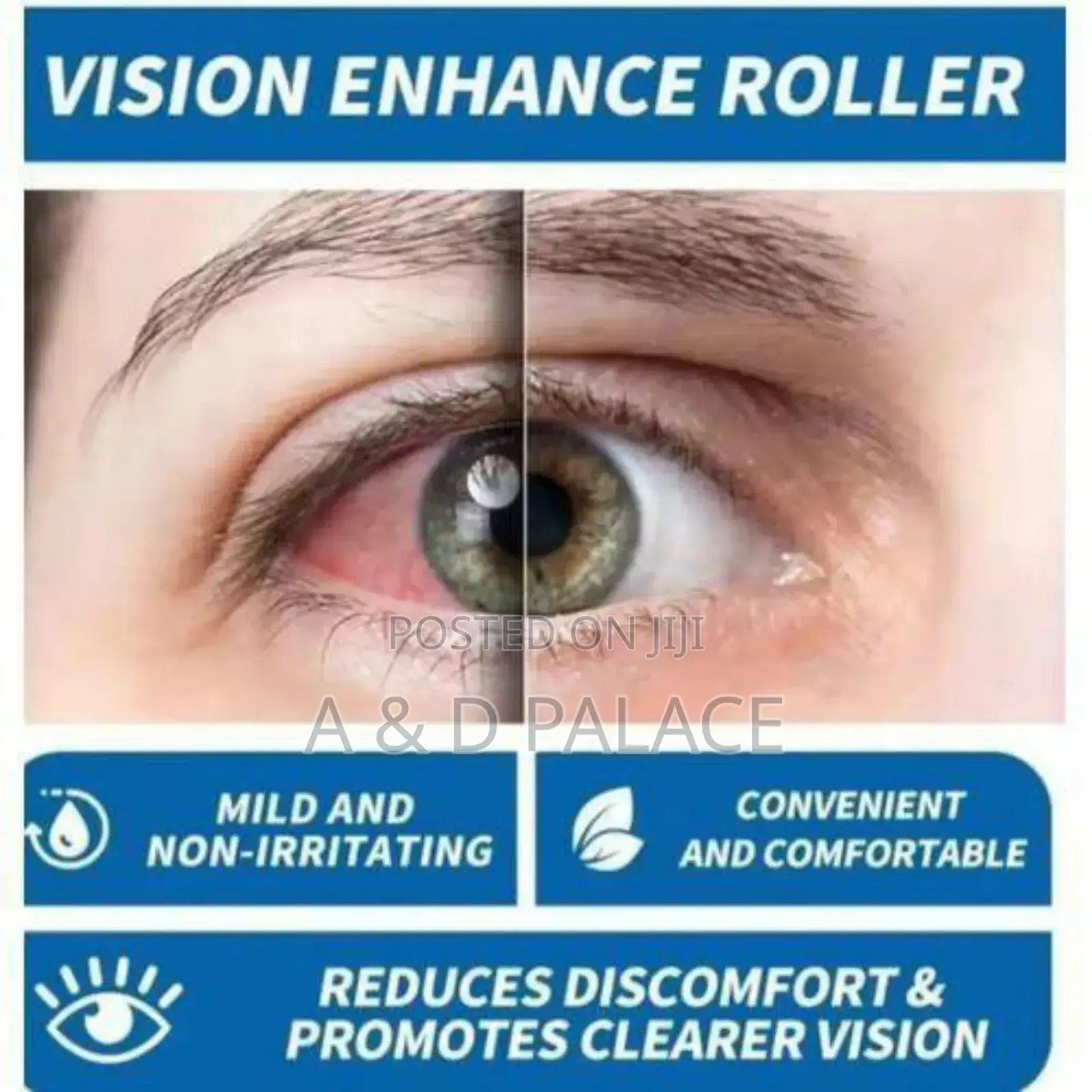 South Moon Cold Compress Gel for Dry Eyes Glaucoma Blurred Vision