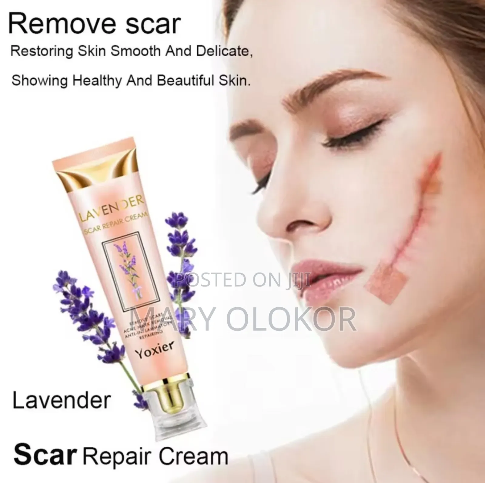 Yoxier Scar Removal/Remover Cream