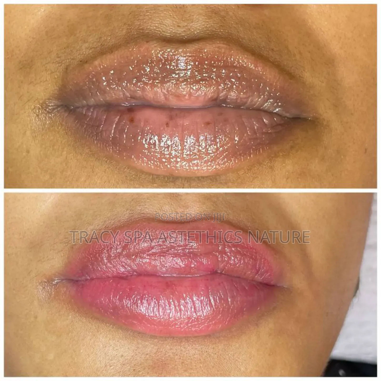 Lip Blushing