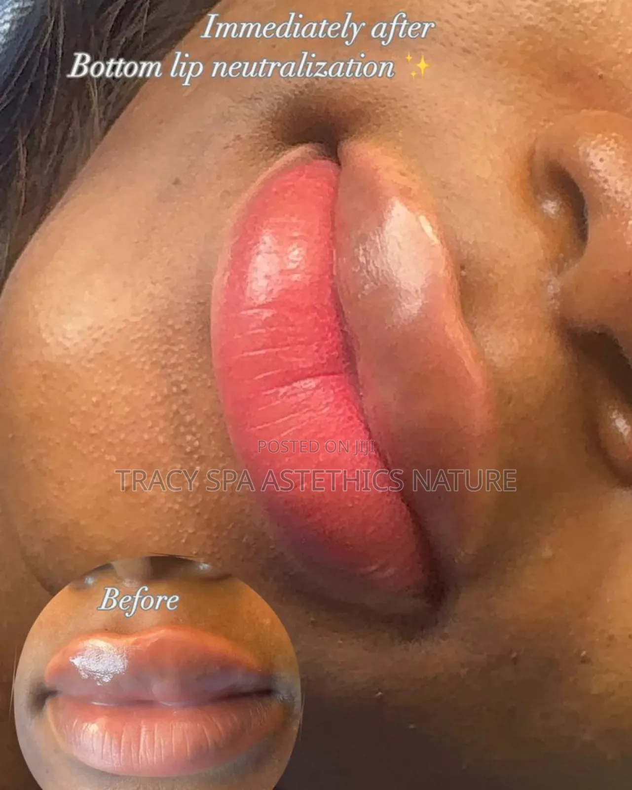 Lipp Blush