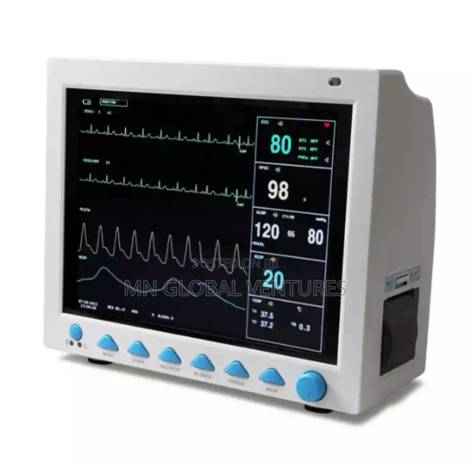 Patient Monitor