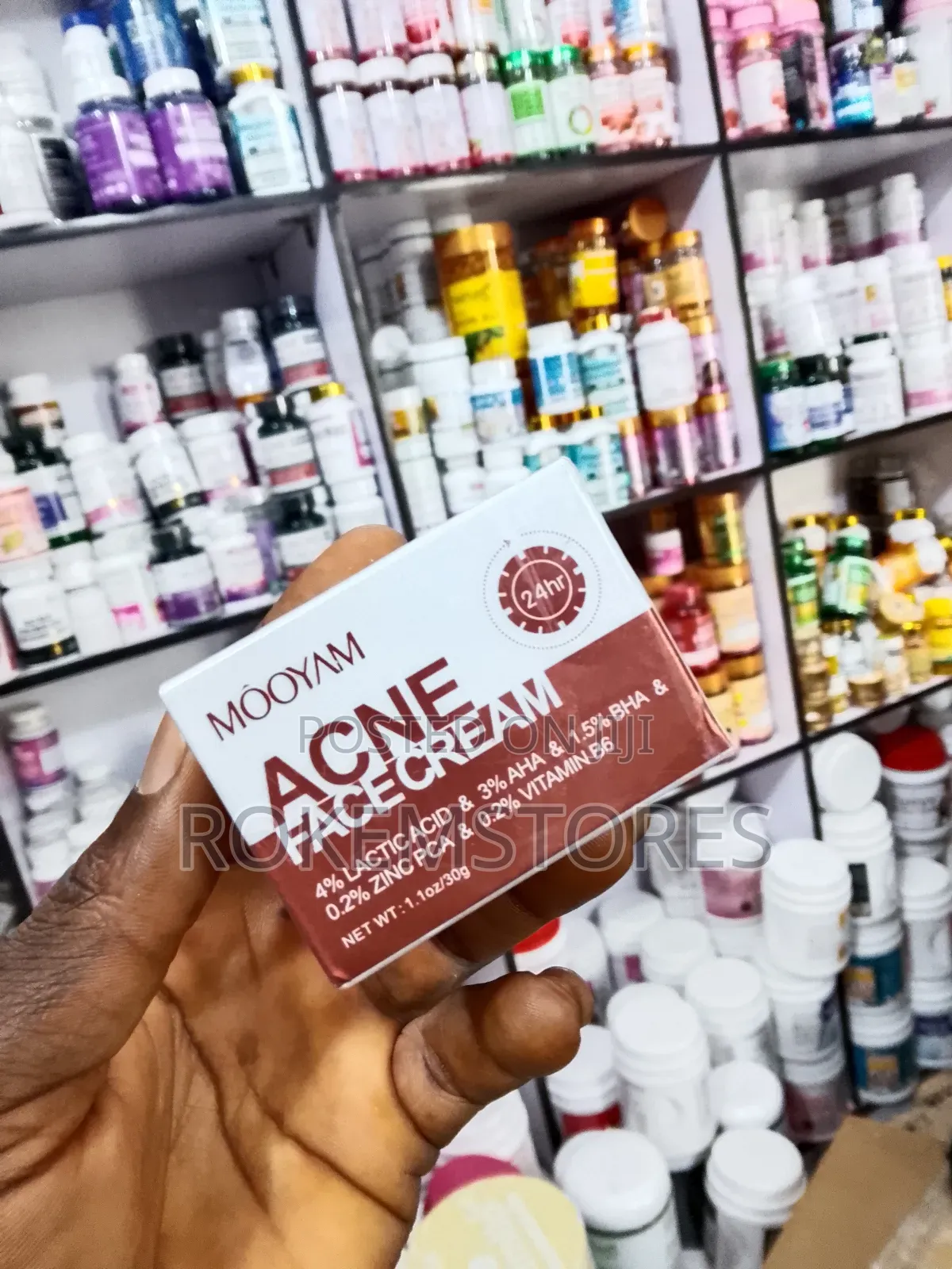Acne Face Cream