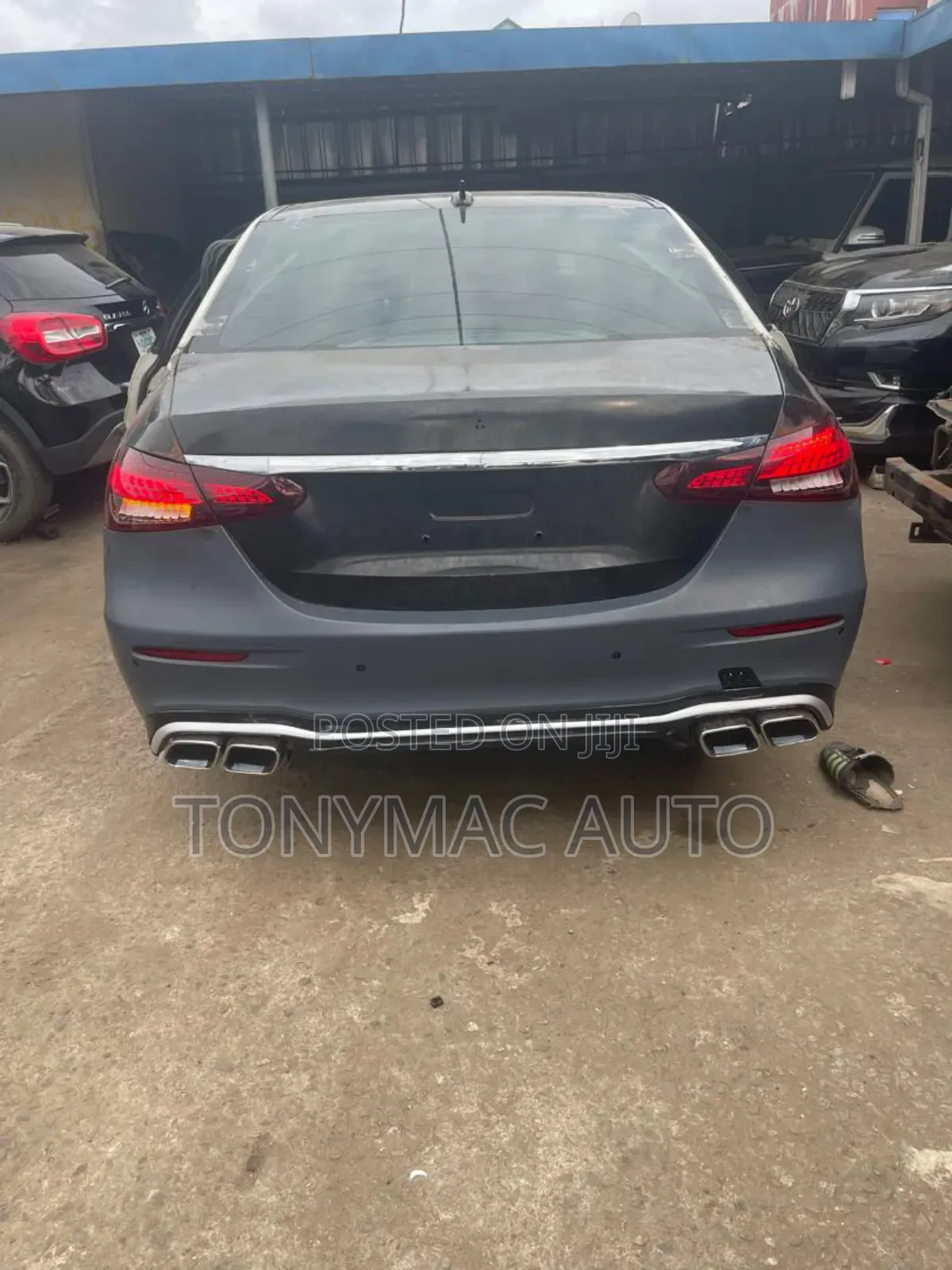 Mercedes Benz E300 2017,2018 Upgraded To 2022 Upgrade Kits