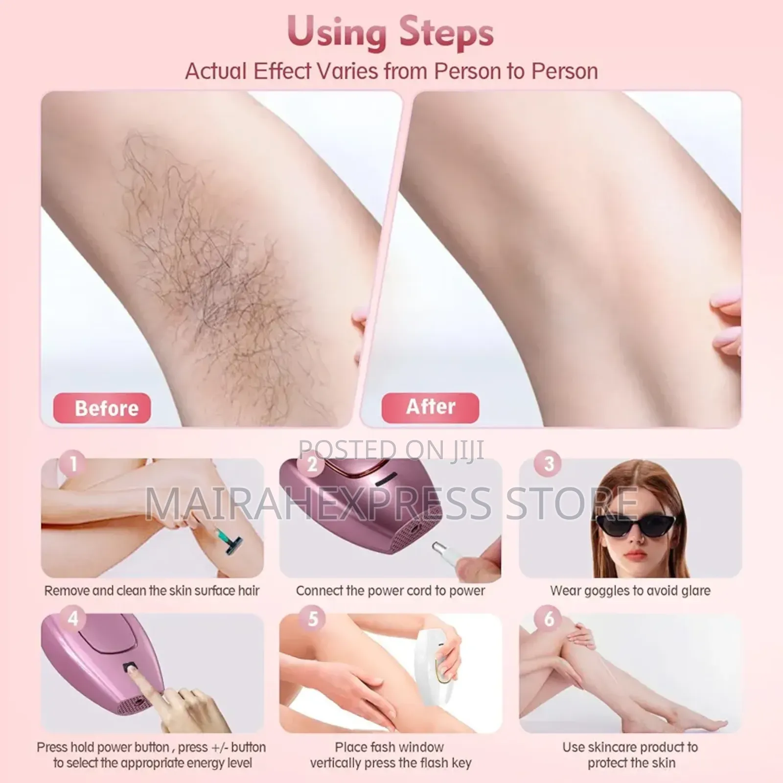 Ipl Laser Hair Removal Epilator (2st7)