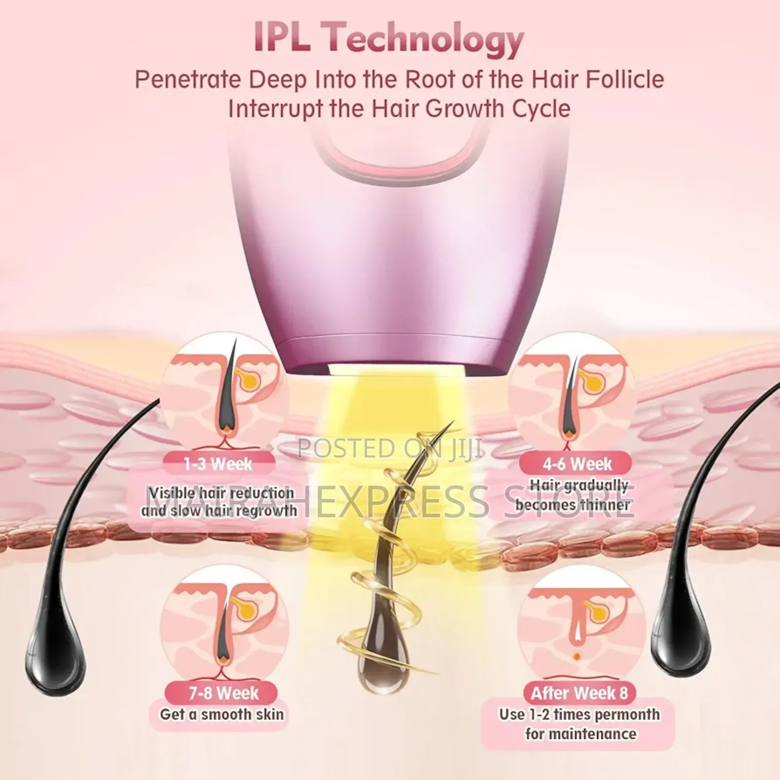 Ipl Laser Hair Removal Epilator (2st7)