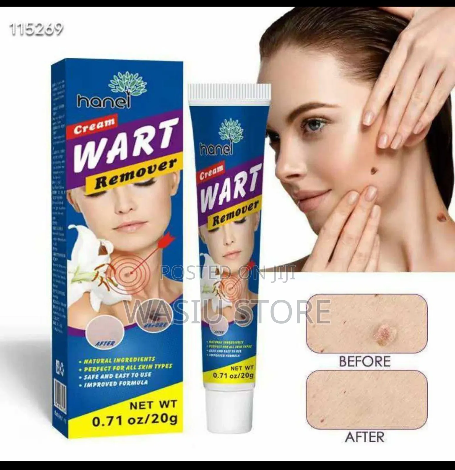 Skin Tag Removal Cream