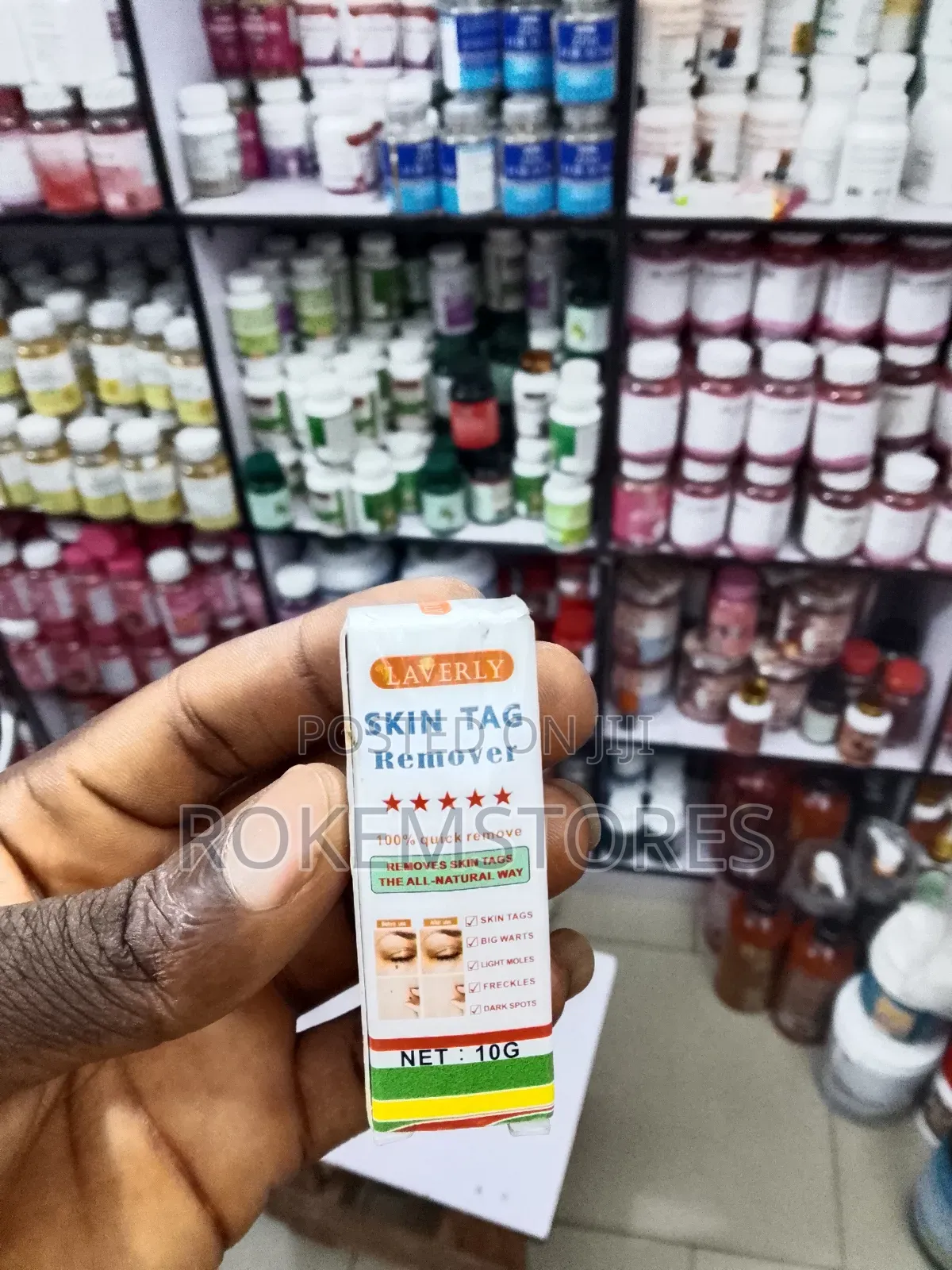 Lavely Skin Tag Remover