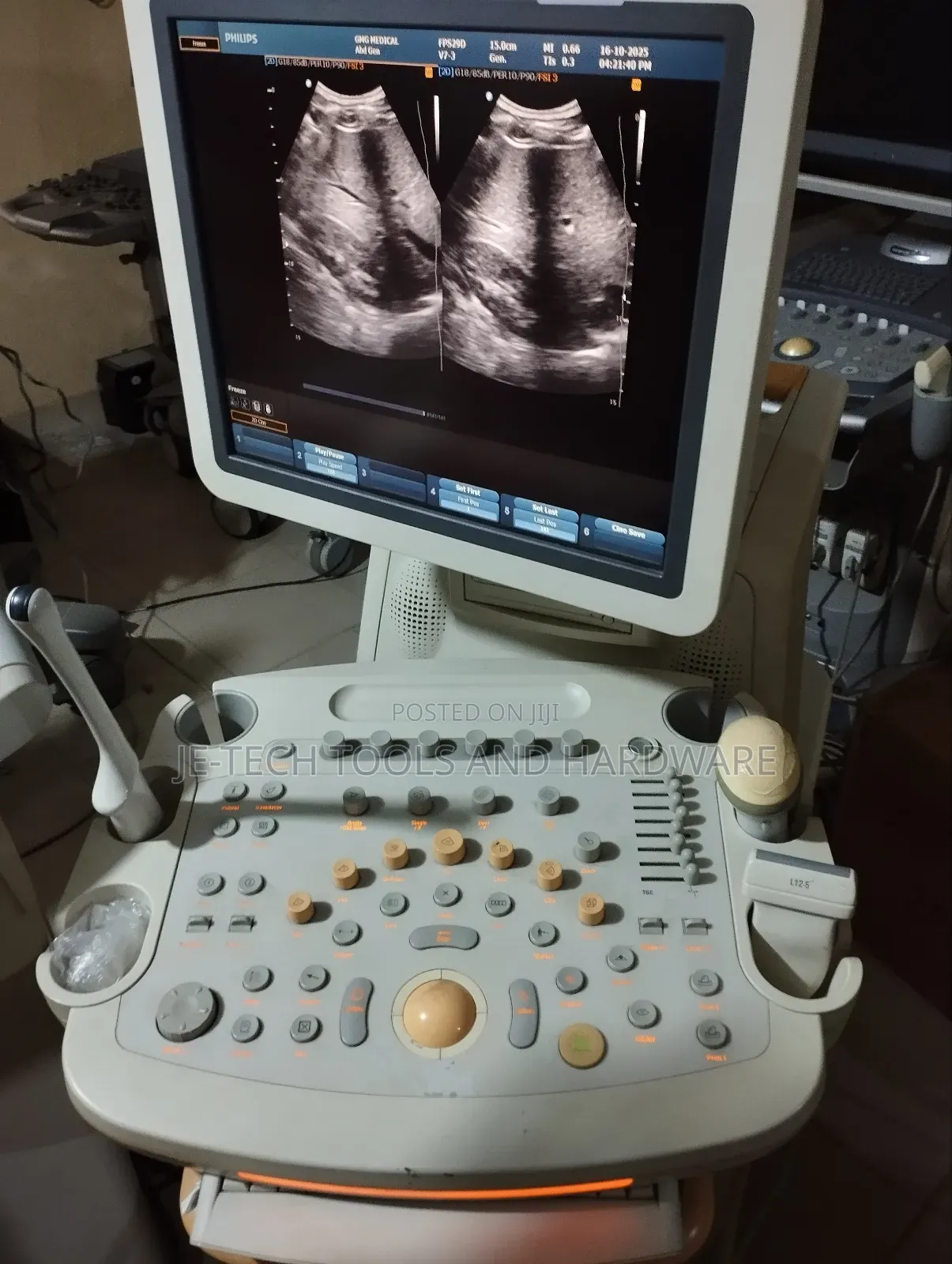 4d Philips Hd9 Ultrasound Machine