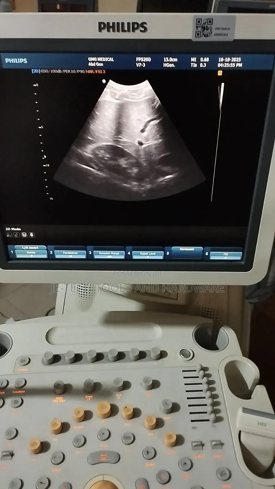 4d Philips Hd9 Ultrasound Machine