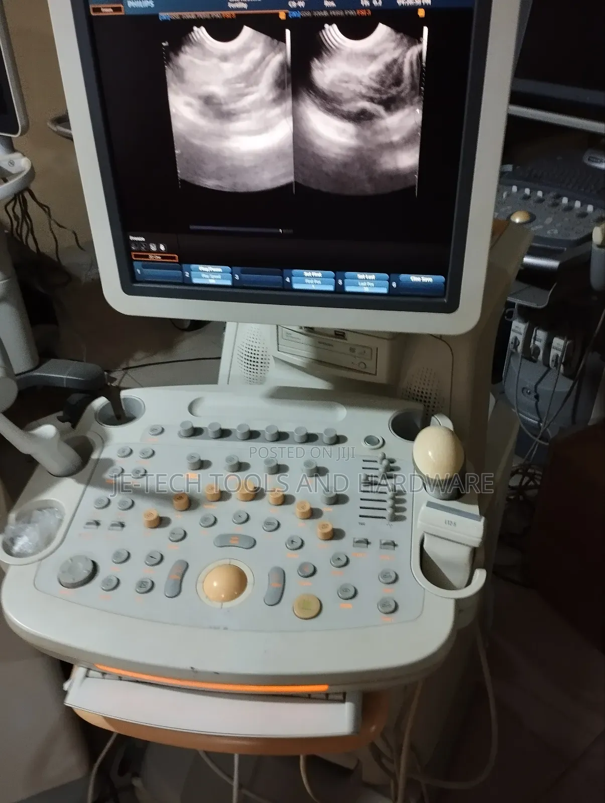 4d Philips Hd9 Ultrasound Machine