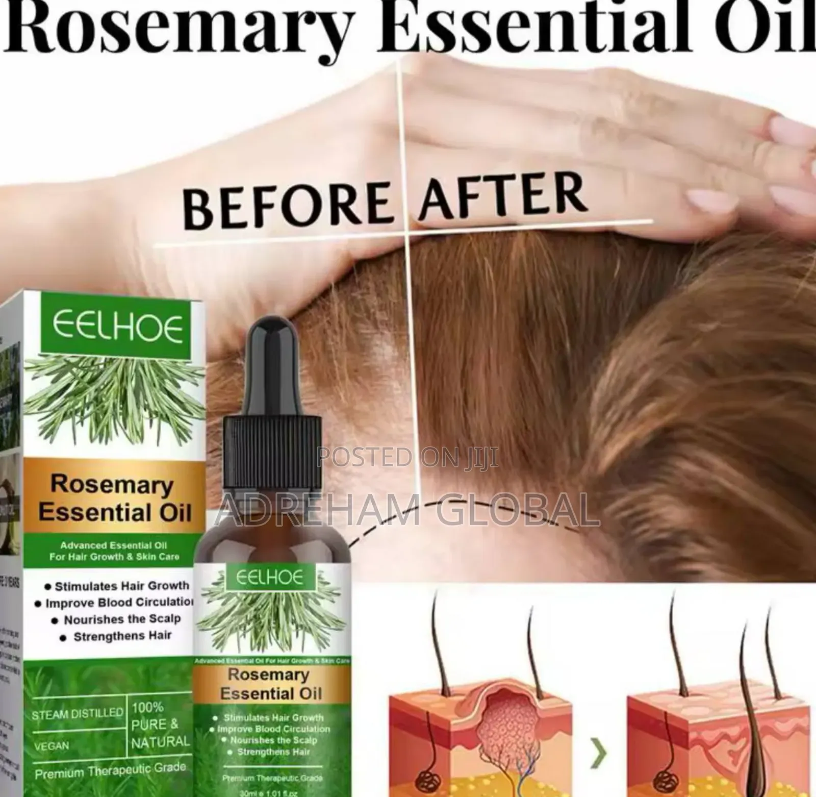 Hair Growth Rosemary Oil Fast Growing Hair Essential Oil For Men Women
