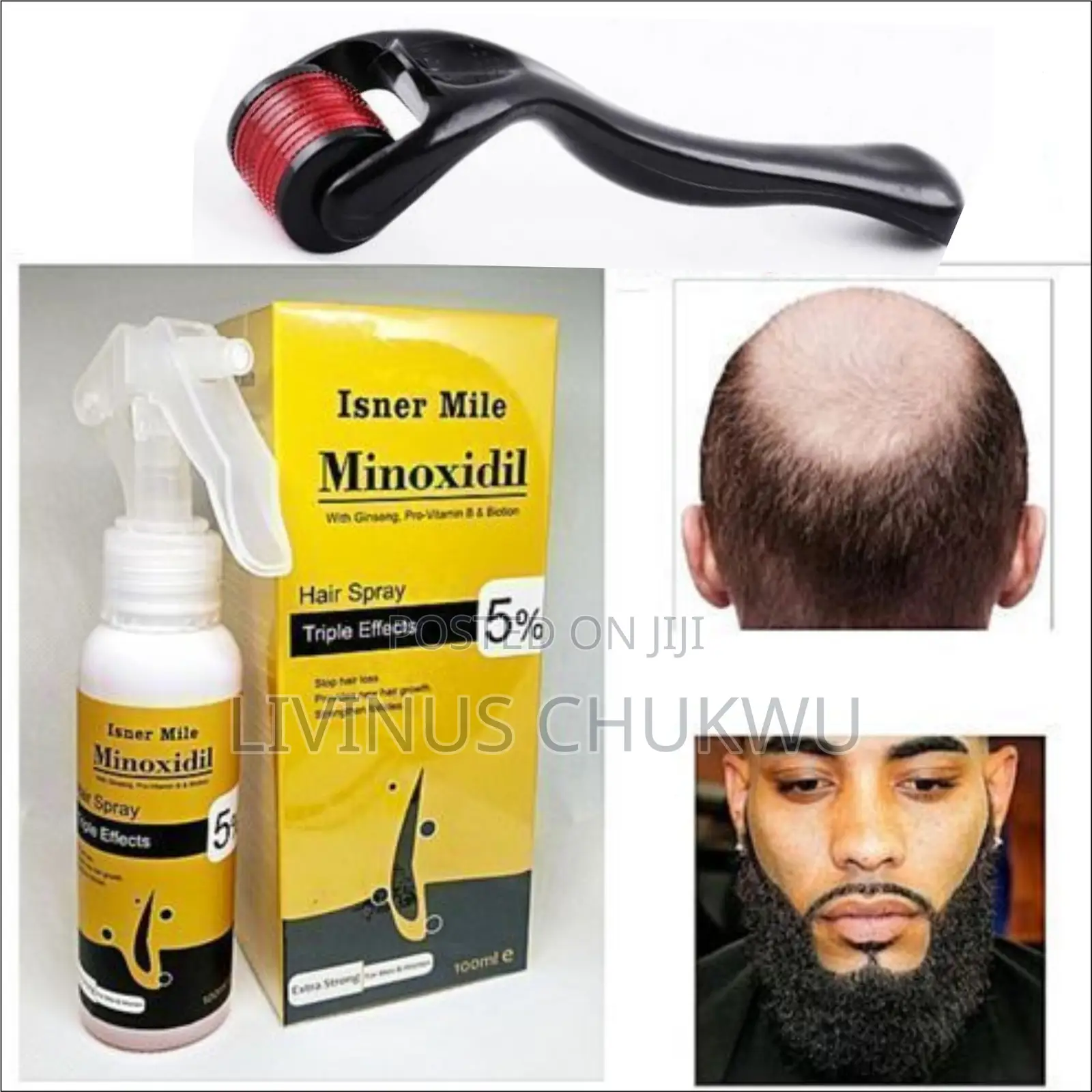 Isner Mile Minoxidil 5% Biotin Ginseng Hair Growth Plus Derma Roller