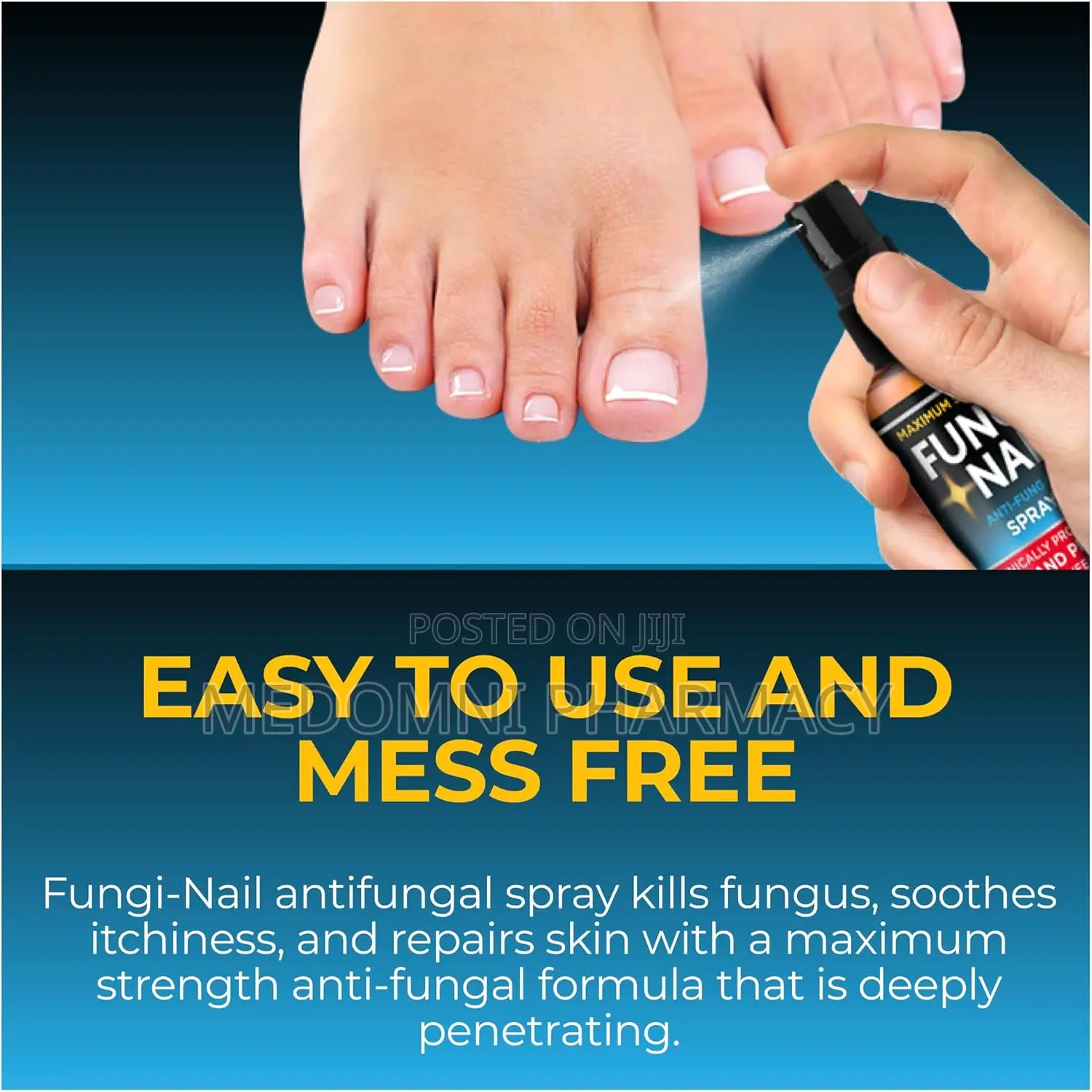 Fungi-Nail Anti-Fungal Foot Spray 1oz –