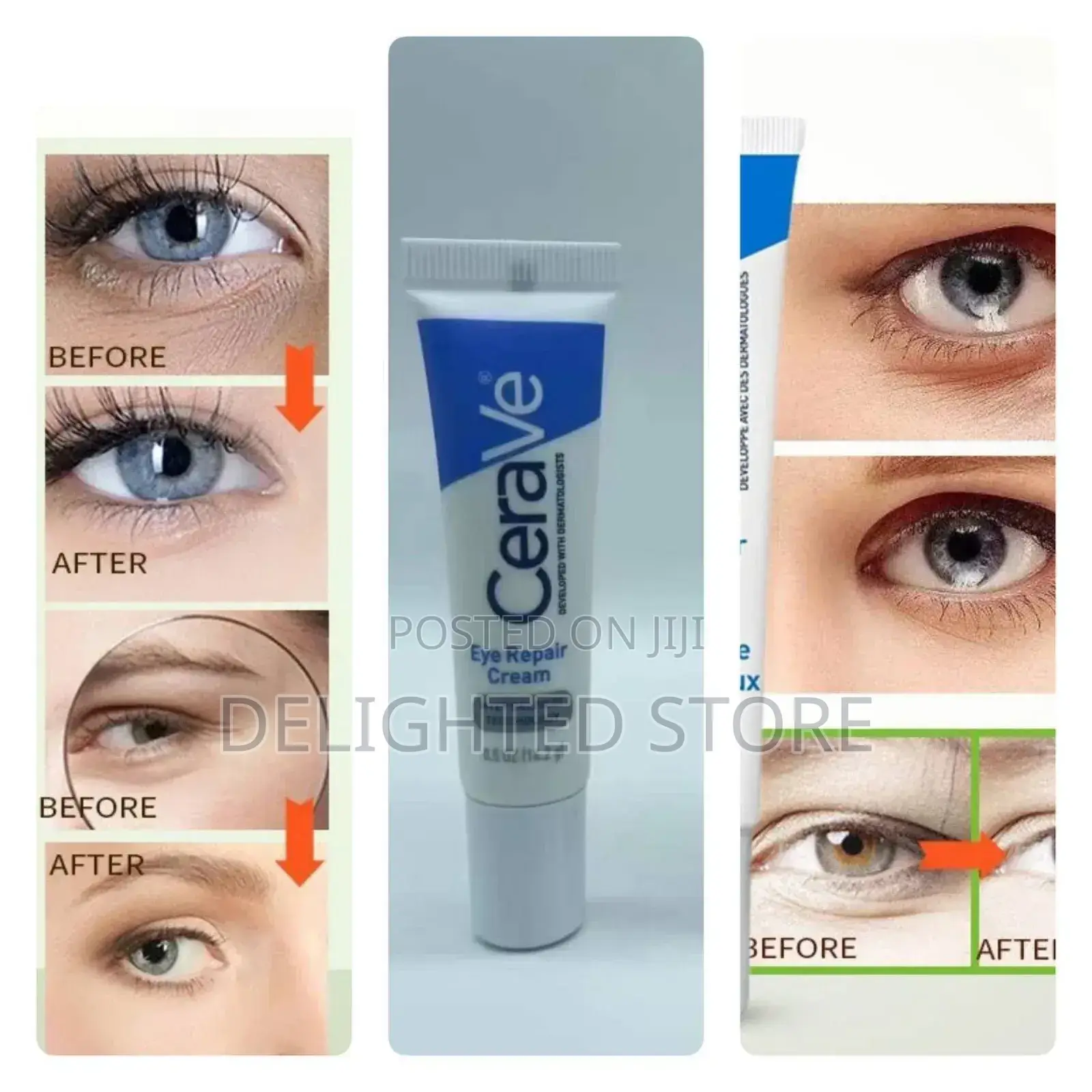 Cerave Eye Repair Cream For Dark Circles And Puffiness (14.2g)