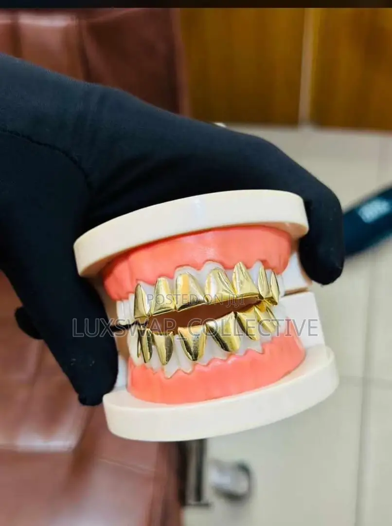 Gold Teeth Grillz – Custom Fit Stylish Design