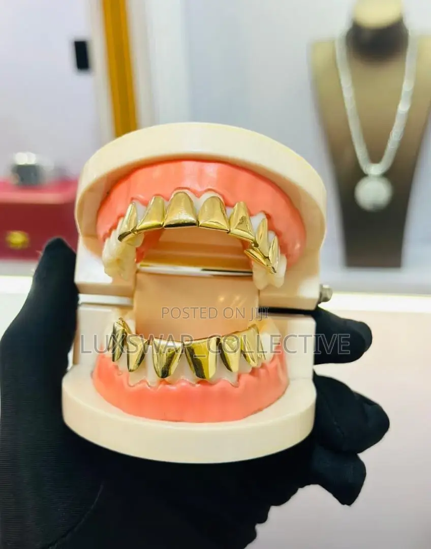 Gold Teeth Grillz – Custom Fit Stylish Design