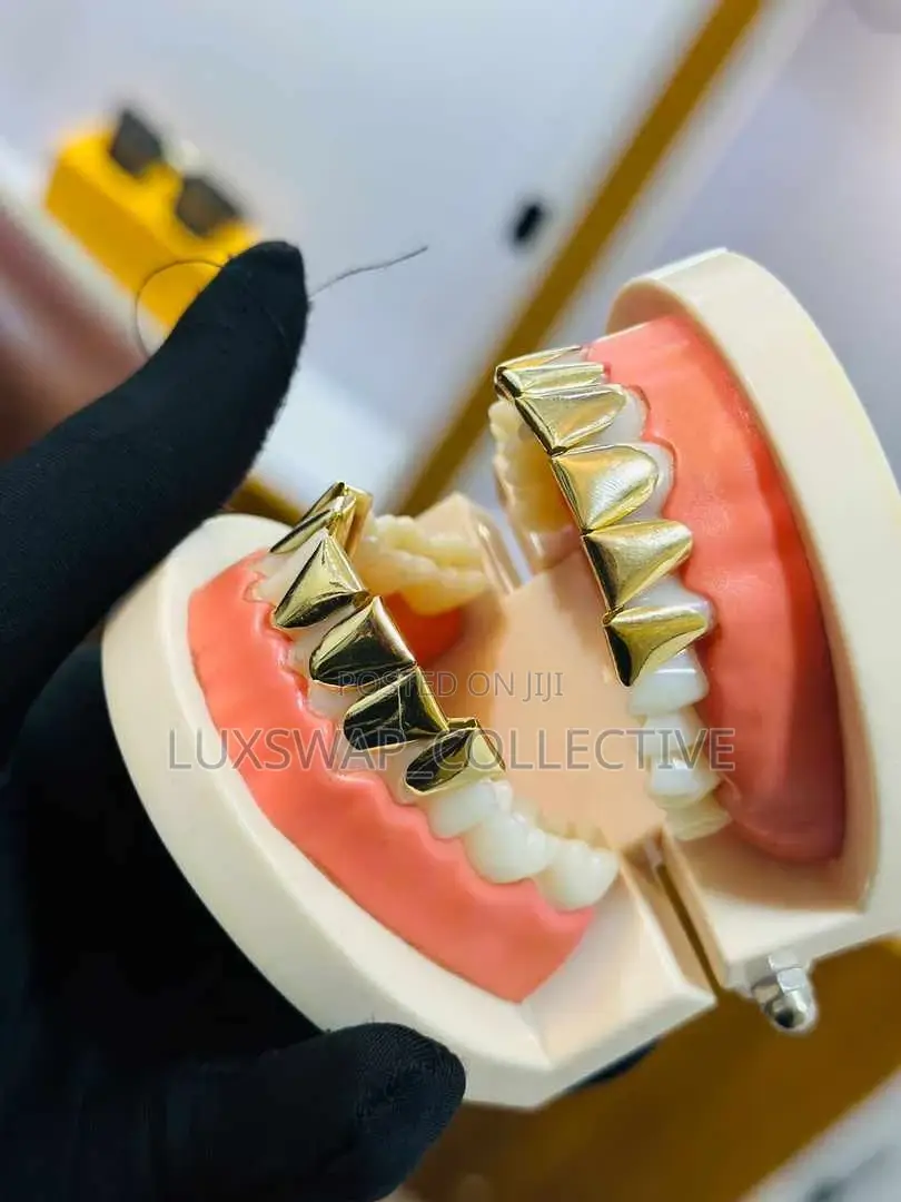 Gold Teeth Grillz – Custom Fit Stylish Design