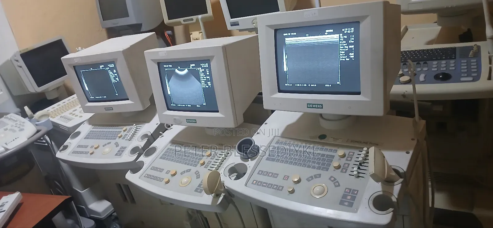 Siemens Sonoline Prima