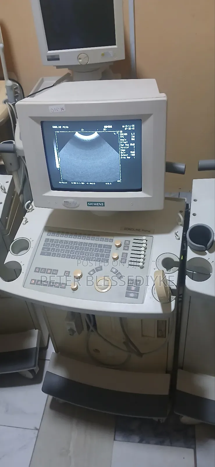 Siemens Sonoline Prima