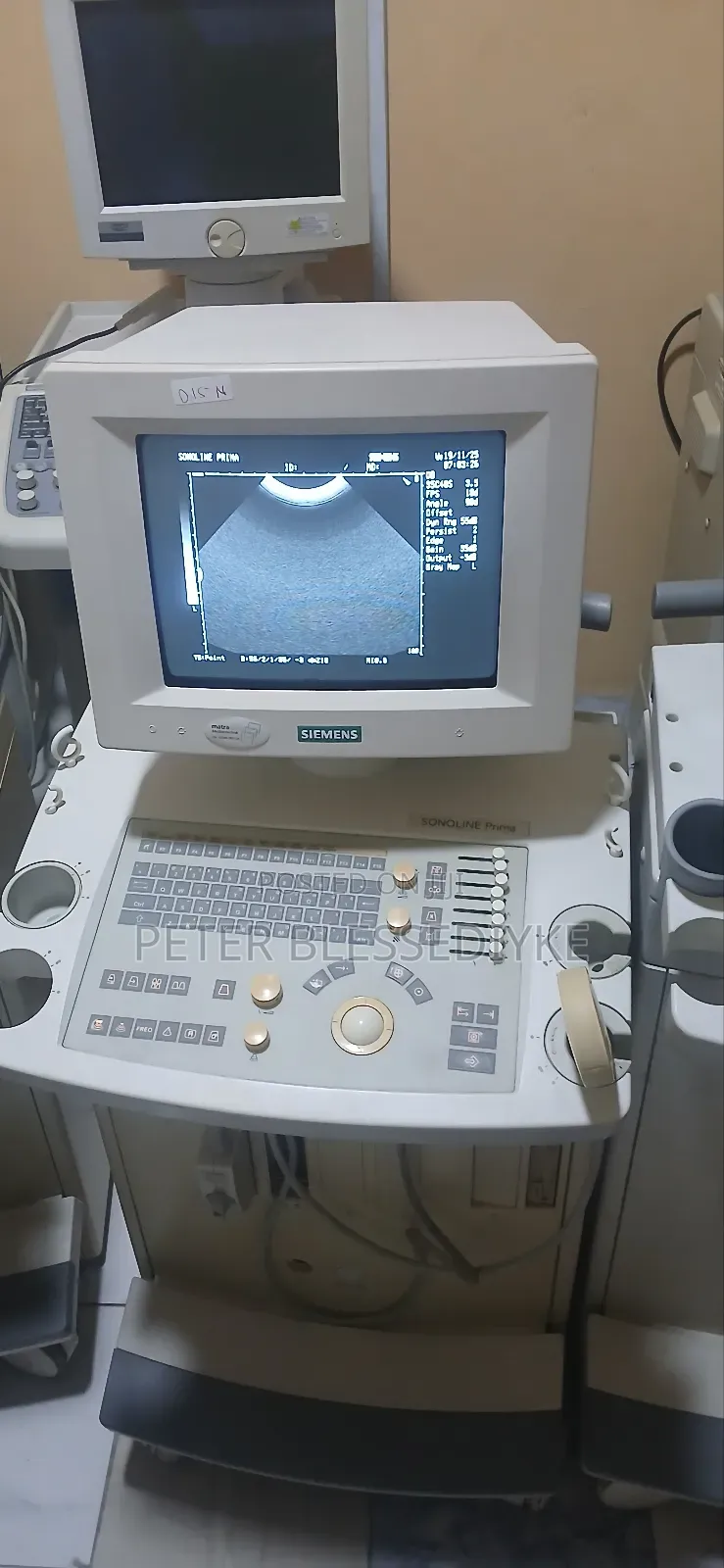 Siemens Sonoline Prima